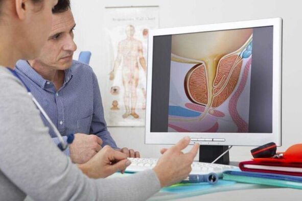 le médecin consulte le patient au sujet de la prostatite