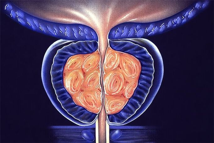 Symptômes et traitement de la prostatite