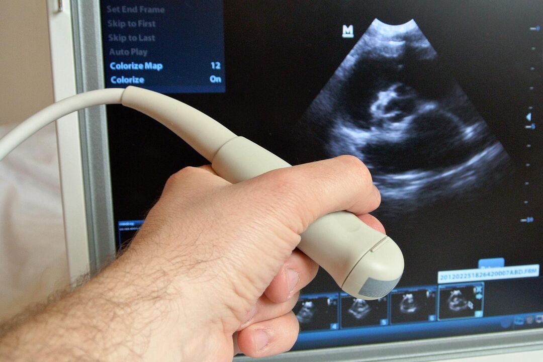 L'échographie aidera à diagnostiquer la prostatite congestive chez un homme.